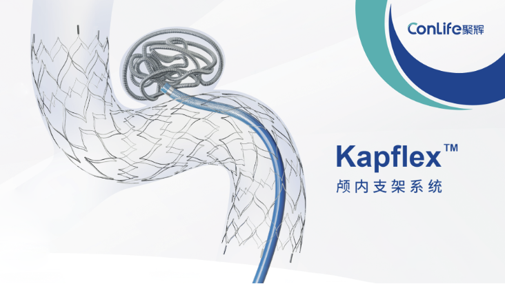 Kapflex™颅内支架系统完成人体临床试验首例入组