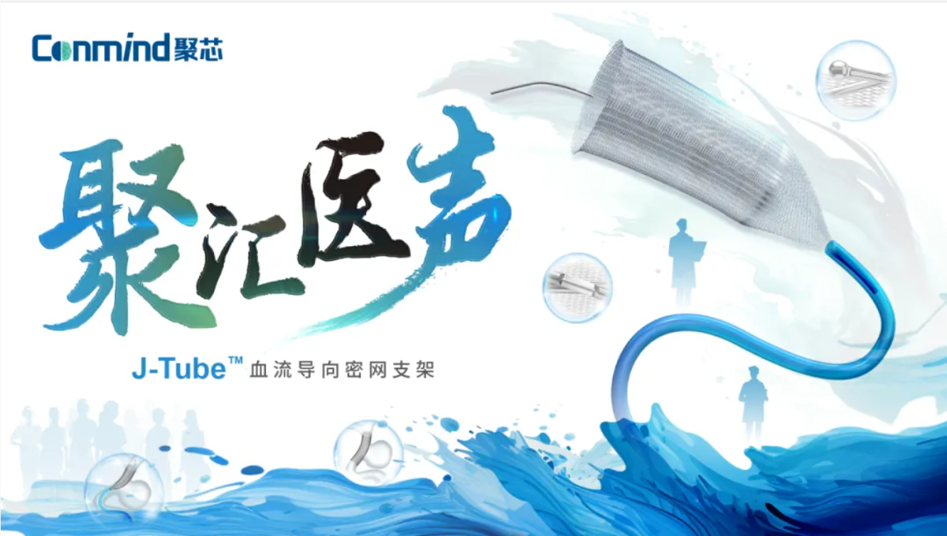 【聚汇医声】J-Tube™密网支架治疗动脉瘤两例