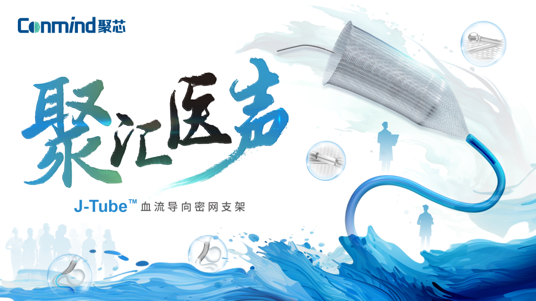 【聚汇医声】林浩教授团队：J-Tube™血流导向密网支架治疗左侧颈内动脉C6段多发动脉瘤