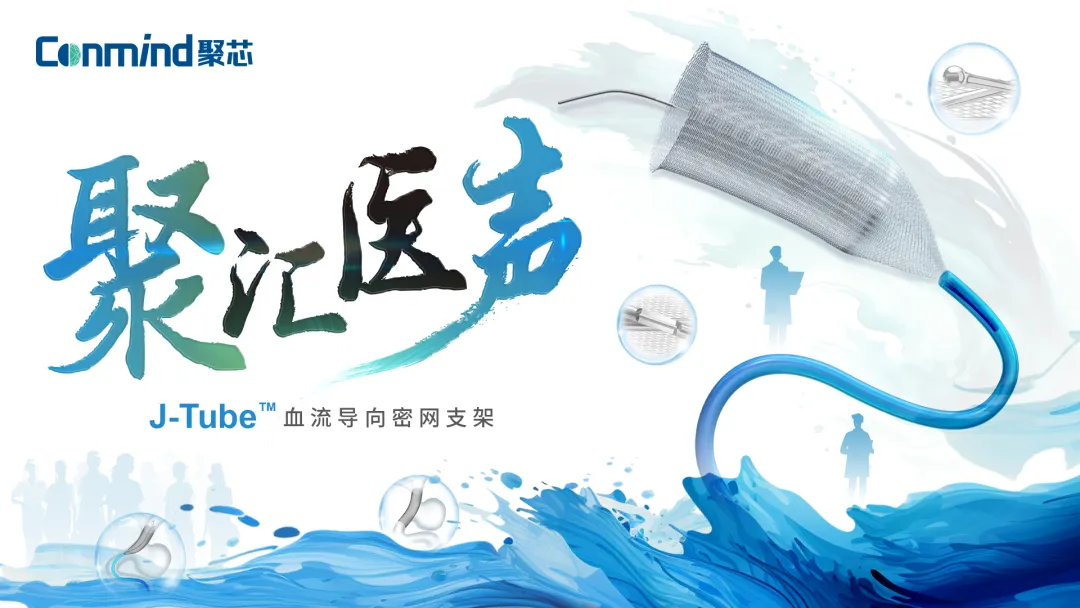 【聚汇医声】于嘉教授：J-Tube™密网支架治疗颈内动脉C2段夹层动脉瘤